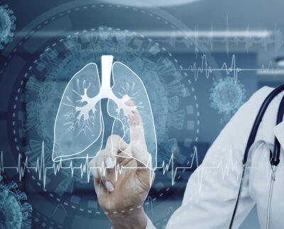 Umelá inteligencia pomáha pri detekovaní rakoviny pľúc
