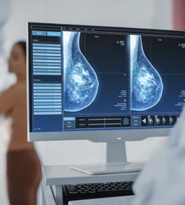 mamografia