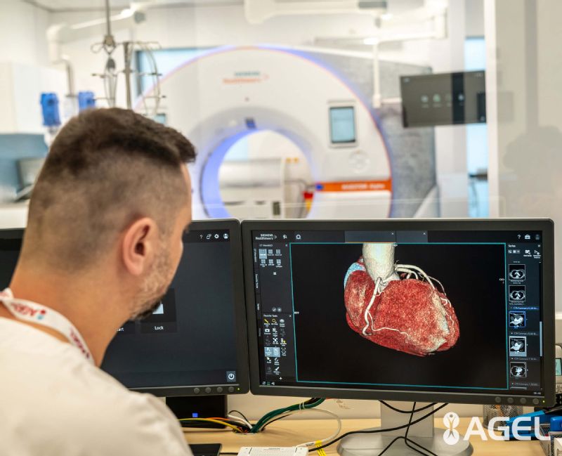 Kardiocentrum v Šaci spustilo prevádzku unikátneho CT