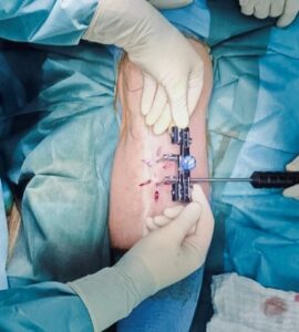 unikatna-metoda Prešov