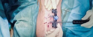 unikatna-metoda Prešov