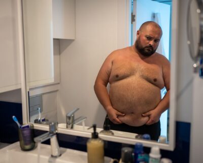 obezita